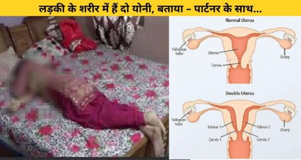 लड़की की शारीरिक विकृति बनी उसके लिए कयामत, किया दर्द को बयां
