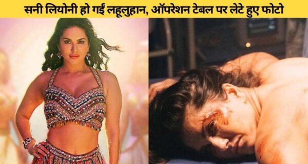 ऑपरेशन टेबल पर लहूलुहान सनी लियोन को देख फैंस हुए पागल