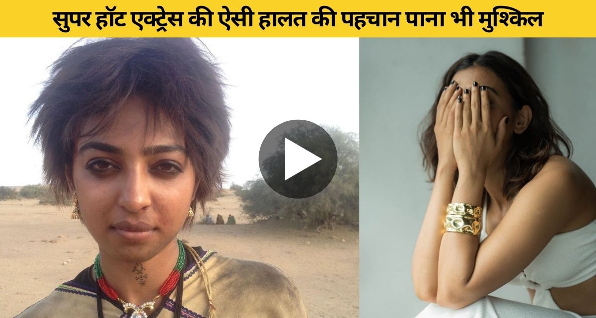 This is the condition of Radhika Apte