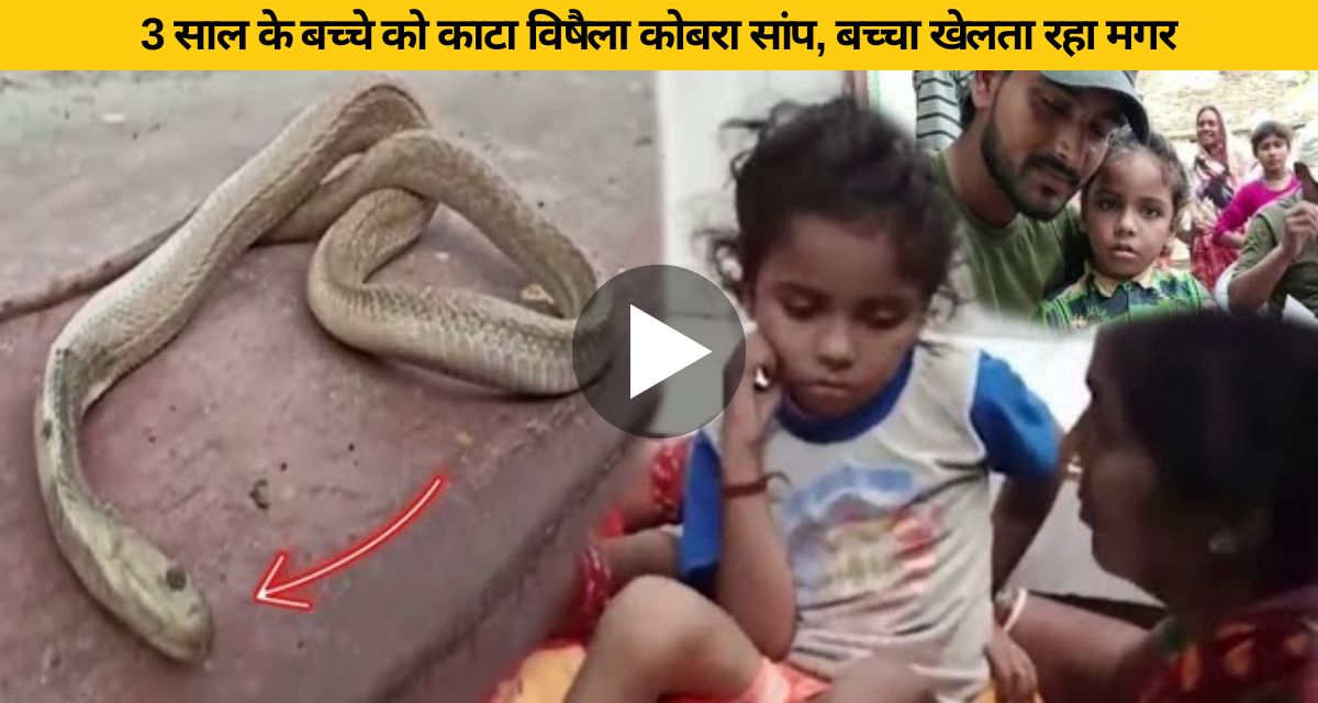 A 3-year-old child was bitten by a poisonous cobra