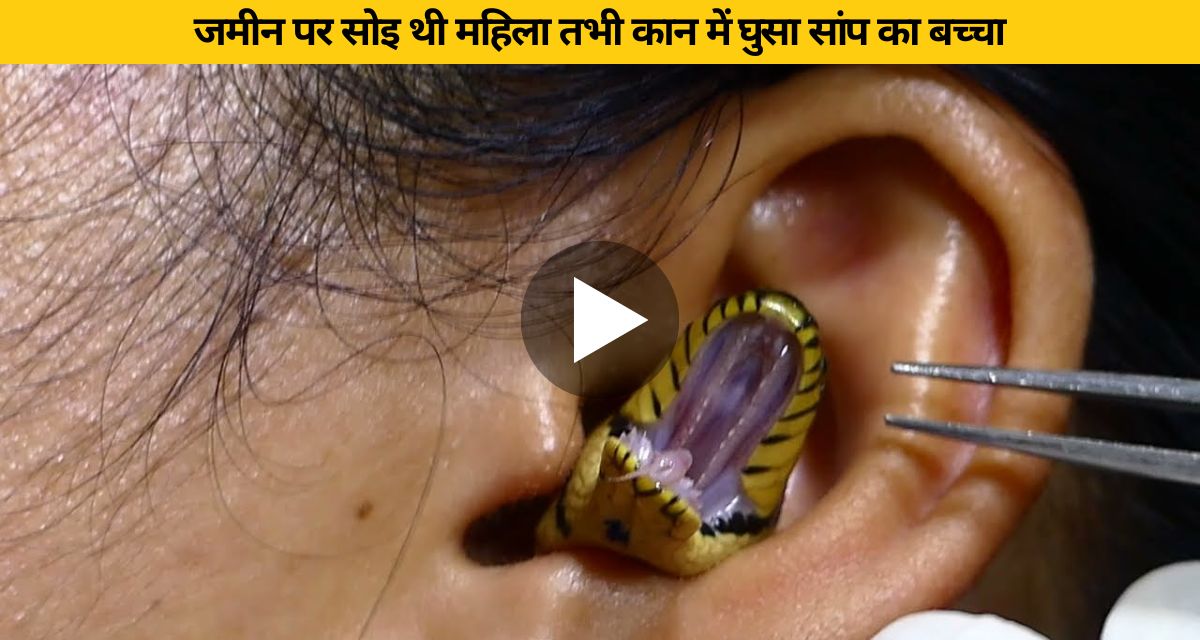 snake entered girl's ear